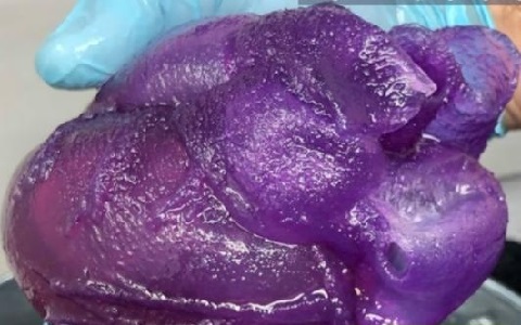 極光創(chuàng)新：首個(gè)全尺寸3D打印人類(lèi)心臟模型面世